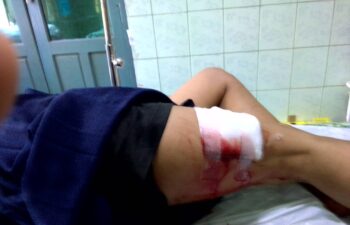Image for KECD School Teacher Wounded by Karen Border Guard Force Attack