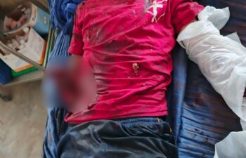 Image for Two Students Injured by Unexploded Ordnance Following Airstrike in Hpaw Taw Village East